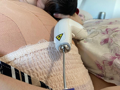 Foto de um aparelho de laserterapia sobre a barriga de uma gestante.